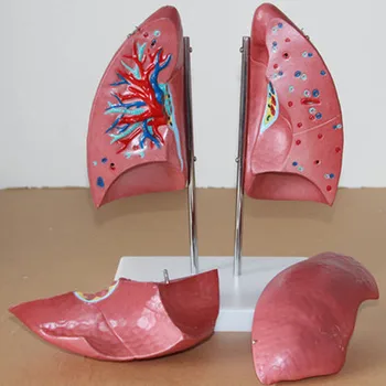 1:1 анатомическая модел на белия дроб Дихателна система на човека, Бронхиална Модел на Здравно Обучение безплатна доставка